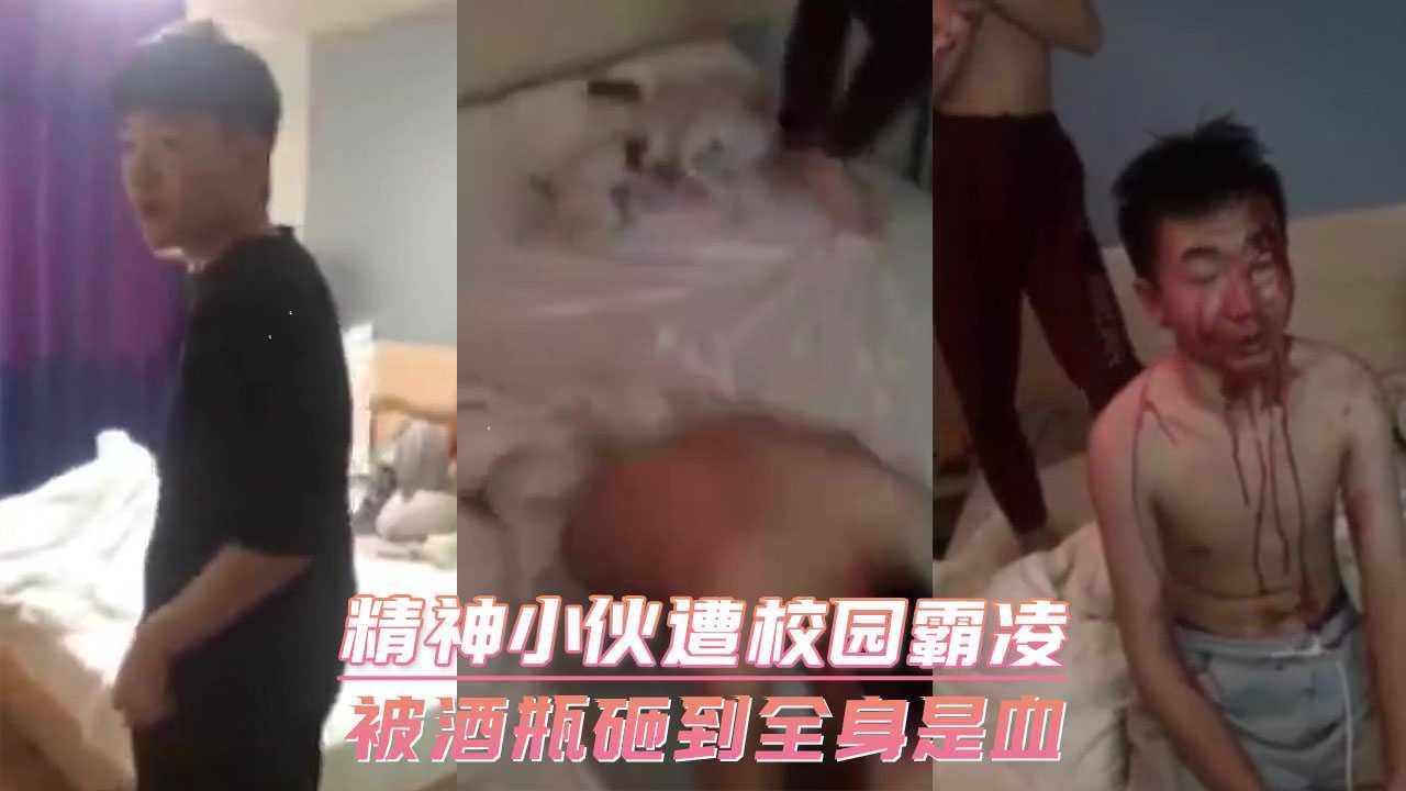 精神小伙遭校园霸凌 被酒瓶砸到全身是血..